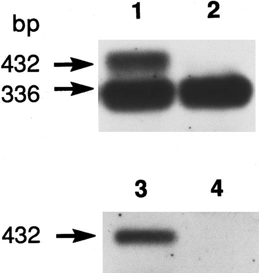 Fig. 2. Southern blot hybridization of RT-PCR products. Oligo-dT primed reticulocyte RNA was used for PCR with primers R-4 and R-5 flanking exon 7 of the R-PK cDNA. Normal R-PK cDNA is 336 bp long, which includes 25, 271, and 40 bp cDNA sequences of exon 6, 7, and 8. If the 96 bases of the seventh intervening sequence are retained, the aberrant cDNA becomes 432 bp long. Oligonucleotide EX-7 hybridized with exon 7 (lane 1, PK Kowloon, lane 2; control), and IVS-7 hybridized with intron 7 (lane 3, PK Kowloon, lane 4; control).
