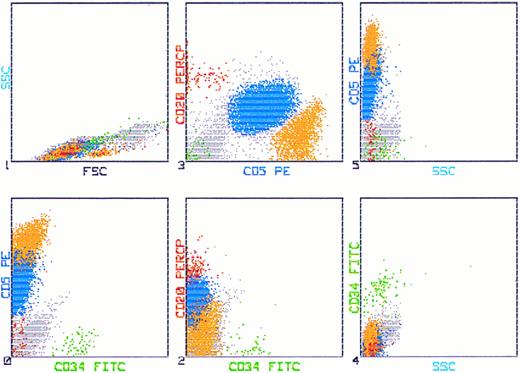 Fig. 4. Flow cytometric analysis of bone marrow of a CLL patient stained with CD34 FITC (HPCA-2), CD20 PerCP (L27), and CD5 PE (L17F12). Fifty thousand cells were aquired in listmode on a FACScan. The leukemic cells are depicted blue by simultaneous analysis of CD5 PE and CD20 PerCP, whereas the CD34+ cells appear as green. There is no population detectable coexpressing CD34, CD5, and CD20.