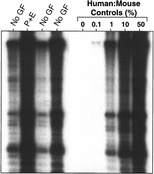 Fig. 3. Lack of effect of injections of PIXY321 and Ep (7 μg and 20 U/mouse, respectively, every other day until killed) on the level of human cell engraftment obtained in the marrow of CB17/SCID mice 5 to 6 weeks after the transplantation of 4 × 107 human marrow cells, as assessed by Southern analysis using a human chromosome 17-specific α-satellite probe. Human:mouse DNA controls are given as % human DNA.
