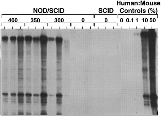 Fig. 4. Effect of irradiation dose (indicated in cGy) on the level of human cell engraftment seen in the marrow of NOD/SCID or SCID mice transplanted with 2 × 107 human marrow cells and analyzed 5 weeks later by Southern blot analysis using a human chromosome 17-specific α-satellite probe.