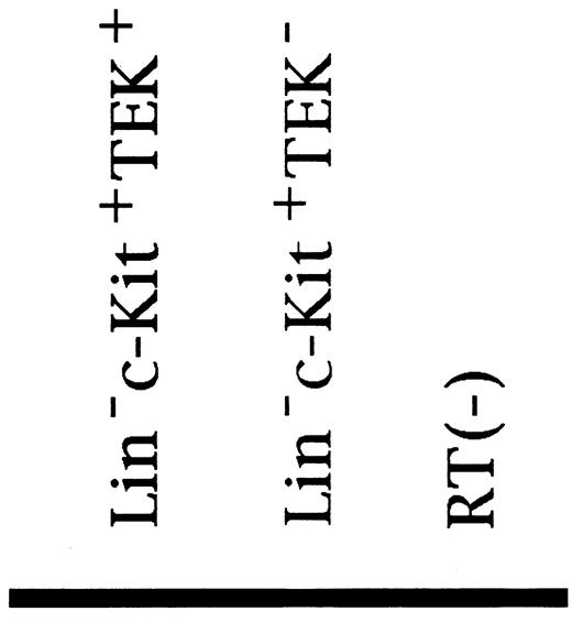 Fig. 5. RT-PCR analysis of TIE and TEK expression in fractionated HSCs (ethidium bromide staining). TIE (301 bp) was expressed in both TEK+ and TEK− cells, and TEK (456 bp) was expressed on both TIE+ and TIE− cells (data not shown).