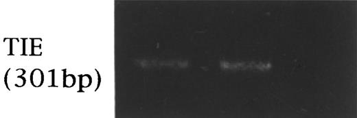 Fig. 5. RT-PCR analysis of TIE and TEK expression in fractionated HSCs (ethidium bromide staining). TIE (301 bp) was expressed in both TEK+ and TEK− cells, and TEK (456 bp) was expressed on both TIE+ and TIE− cells (data not shown).