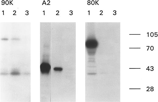 Fig. 1. Epitope mapping of antibodies directed against factor VIII. Recombinant factor VIII fragments corresponding to the factor VIII heavy chain (90K), the A2 domain (A2), and the factor VIII light chain (80K) were expressed in High Five cells and metabolically labeled as described. Binding of anti-factor VIII antibodies to the metabolically labeled factor VIII fragments was assessed by immunoprecipitation and analyzed under reducing conditions on a 10% (wt/vol) SDS-polyacrylamide gel. Lane 1, MoAb CLB-CAg 9 (90K, A2) or CLB-CAg 117 (80K); lane 2, anti-factor VIII antibodies present in the patient's plasma (sample from 1992); and lane 3, control plasma. Immunoprecipitation of the metabolically labeled factor VIII heavy chain gave rise to a nonspecific band of approximately 40 kD. Molecular weight markers are given on the right of the figure.