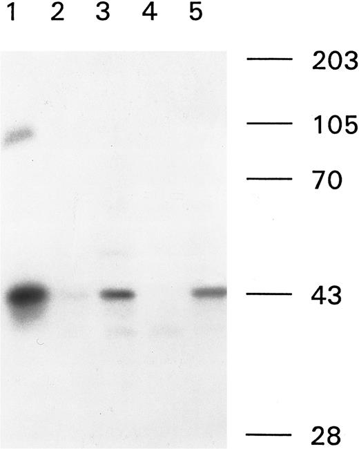 Fig. 2. Subclass determination of anti-factor VIII antibodies. Binding of anti-factor VIII antibodies to metabolically labeled A2 domain was performed by immunoprecipitation using subclass-specific MoAbs. Immunoprecipitations were analyzed under reducing conditions on a 10% (wt/vol) SDS-polyacrylamide gel. The results of a plasma sample of patient A from 1992 are shown. Lane 1, total IgG; lane 2, IgG1; lane 3, IgG2; lane 4, IgG3; and lane 5, IgG4. Molecular weight markers are given at the right of Fig 2. No binding to αIgM was found (data not shown).