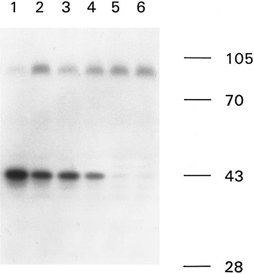 Fig. 3. Binding of anti-factor VIII antibodies over time. Immunoprecipitation analysis of antibodies binding to the A2 domain of factor VIII, with plasma samples of patient A from various time points. Lanes 1 through 4, plasma of patient A from 1992, 1993, 1994, and 1995; and lanes 5 and 6, plasma of patient B from 1993 and 1995. Some nonspecific binding of a protein of approximately 100 kD was observed in this particular experiment. A molecular weight marker is given on the right of the figure.