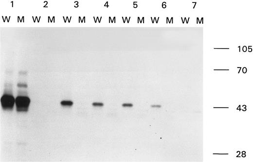 Fig. 4. Binding of anti-factor VIII antibodies to wild-type and modified A2 domain. Immunoprecipitation analysis of antibody-binding to the wild-type A2 domain (W) and the A2 domain with the Arg593 → Cys substitution (M). Sample 1, MoAb CLB-CAg 9; sample 2, control plasma; samples 3 through 6, plasma of patient A from 1992, 1993, 1994, and 1995; and sample 7, plasma of patient B from 1993. At the right side of the figure the molecular weight marker is depicted.