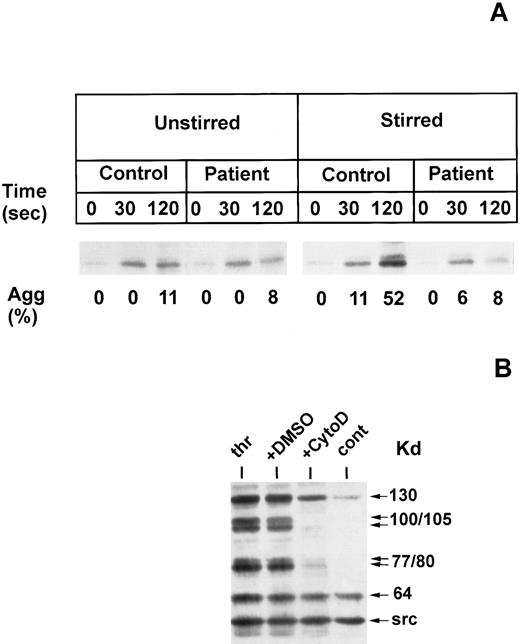 Fig. 4. (A) Kinetics of tyrosine phosphorylation of cortactin as a function of aggregation by comparison of unstirred and stirred control and thrombasthenic platelets. Platelets from control (control) or the Glanzmann thrombathenia patient of Fig 1A (patient) were activated with 0.05 U thrombin in nonstirring (unstirred) or stirring (stirred) conditions for 0, 30, and 120 seconds. Solubilized platelet proteins were analyzed for tyrosine phosphorylation by Western blotting. Aggregation rates are indicated. Arrows designate cortactin. (B) Effect of cytochalasin D on tyrosine phosphorylation of cortactin and 64 kD. Control platelets were activated with 0.1 U thrombin for 2 minutes with stirring after preincubation for 10 minutes at 37°C in the presence of buffer alone (thromb), 100 μmolL cytochalasin D (cytoD), or DMSO (DMSO). Unactivated platelets were incubated in parallel (control). Tyrosine-phosphorylated proteins were detected by Western blotting, and 130 kD, 100 to 105 kD, 77 to 80 kD, 64 kD, and src are indicated by arrows.