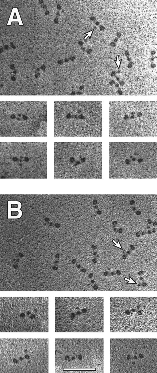 Fig. 7. Transmission electron microscopy of individual fibrinogen molecules. Recombinant fibrinogen is shown in (A) and plasma fibrinogen is shown in (B). The arrows indicate a fourth nodule (made up by the C termini of Aα chains), present on some molecules within a representative field. The smaller panels contain molecules selected to illustrate the various structures with four nodules. All pictures are at the same magnification (60,000×) and the bar in (B) indicates 100 nm.