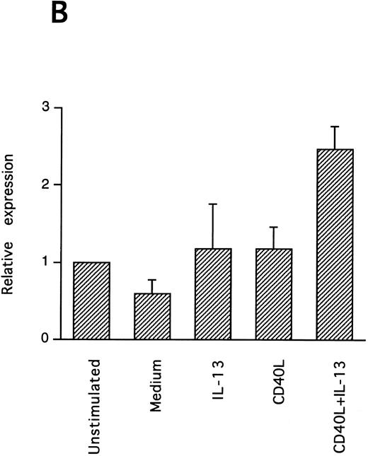 Fig. 7. IL-13–induced PB B-cell survival and expression of Bcl-2 family members. PB B cells were cultured in vitro for 48 hours with the indicated stimuli, and relative protein expression of Mcl-1, Bcl-xL, Bcl-2, Bak, and Bax was determined by Western blotting. Each lane was loaded with 10 μg of total protein, and as a control for equal loading the expression of the nuclear antigen p83 was used. For comparison, levels of Bcl-2 homologues in the B-cell line Karpas 422 are shown. The following concentrations were used: anti-μ (37.5 μg/mL), TPA (10 nmol/L), IL-4 (40 ng/mL), IL-13 (40 ng/mL), and rhuCD40L (10 ng/mL). In (A), one representative blot is shown, whereas the expression of Mcl-1 and Bcl-xL relative to expression in unstimulated cells determined by densitometry is shown in (B) and (C), respectively (mean ± SEM from 3 separate experiments).