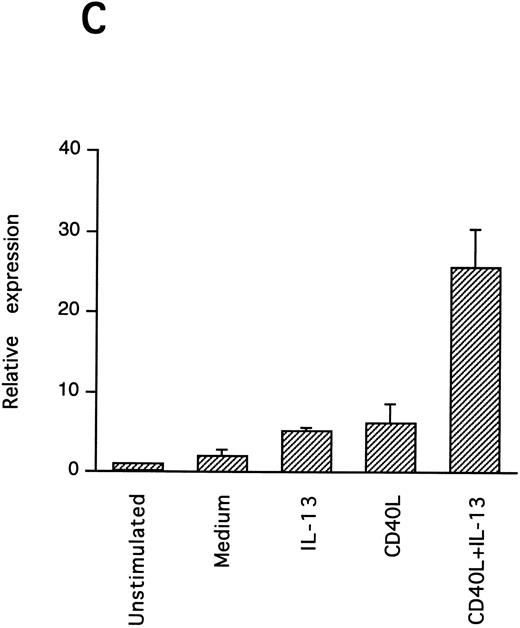 Fig. 7. IL-13–induced PB B-cell survival and expression of Bcl-2 family members. PB B cells were cultured in vitro for 48 hours with the indicated stimuli, and relative protein expression of Mcl-1, Bcl-xL, Bcl-2, Bak, and Bax was determined by Western blotting. Each lane was loaded with 10 μg of total protein, and as a control for equal loading the expression of the nuclear antigen p83 was used. For comparison, levels of Bcl-2 homologues in the B-cell line Karpas 422 are shown. The following concentrations were used: anti-μ (37.5 μg/mL), TPA (10 nmol/L), IL-4 (40 ng/mL), IL-13 (40 ng/mL), and rhuCD40L (10 ng/mL). In (A), one representative blot is shown, whereas the expression of Mcl-1 and Bcl-xL relative to expression in unstimulated cells determined by densitometry is shown in (B) and (C), respectively (mean ± SEM from 3 separate experiments).