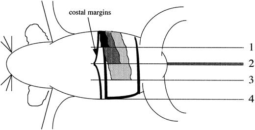 Fig. 1. Determination of spleen indices. The ventral surface of the mouse was divided into four equal quadrants progressing from the left rib cage to the right rib cage. The terminus of each quadrant was assigned a splenic index of 1, 2 (median line of the mouse), 3, and 4 (right rib cage) (see solid lines in figure). Representations of spleens with splenic indices of 1 (black), 2 (dark gray), 3 (light gray), and 4 (white) bordered by black are illustrated. The costal margin is drawn to improve clarity.