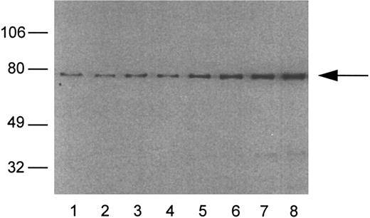 Fig. 7. An analysis of HS1 protein in mixtures of BCL1 cells and normal spleen cells. The percentage of BCL1 cells mixed with spleen cells: lane 1, 0%; lane 2, 2%; lane 3, 5%; lane 4, 10%; lane 5, 20%; lane 6, 30%; lane 7, 40%; and lane 8, 50%. The arrow indicates the position of HS1 at 75 kD. The integrated optical densities of the HS1 band are as follows: lane 1, 5.6; lane 2, 5.9; lane 3, 10.8; lane 4, 10.6; lane 5, 18.9; lane 6, 26.2; lane 7, 37.1; and lane 8, 46.2.
