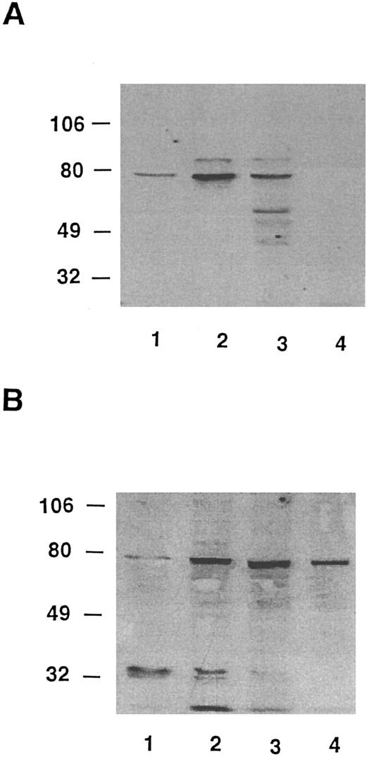 Fig. 8. Western blot analysis of HS1 in escapees. (A) MoAb AHS1. (B) RbAHS1. Lanes were loaded with equal amounts of cell lysates prepared from the same number of cells. Lane 1, 10% BCL1 cells plus 90% normal splenocytes. Lane 2, wild-type-BCL1 tumor. Lane 3, escapee no. 3. Lane 4, escapee no. 6.