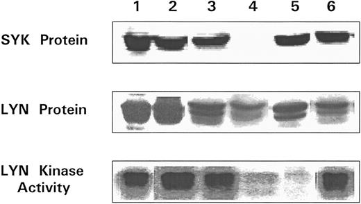 Fig. 9. Analysis of Lyn and Syk proteins and Lyn kinase in escapees. All lysates were prepared from splenocytes recovered from BCL1 tumor bearing nonimmune mice and BCL1 escapees. The presence of Syk (top) and Lyn (center) were determined by immunoblotting. Lyn tyrosine kinase was immunoprecipitated from separate samples and immune complex kinase assay performed (see the Materials and Methods) (bottom). Lane 1, BCL1 ; lane 2, escapee no. 1; lane 3, escapee no. 3; lane 4, escapee no. 6; lane 5, escapee no. 9; and lane 6, escapee no. 10.