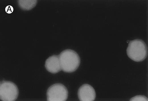 Fig. 2. CD437-induced apoptosis in HL-60R cells. HL-60R cells were grown as described in the Materials and Methods and exposed to either vehicle alone or CD437 (1 μmol/L) for 24 hours and then stained with aciridine orange. (A) Cells exposed to only vehicle. (B) Cells exposed to CD437 (1 μmol/L).