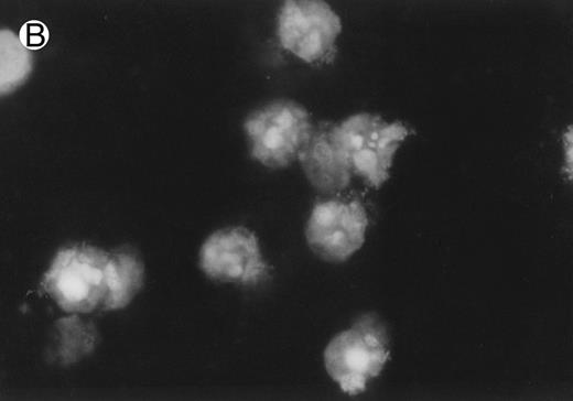 Fig. 2. CD437-induced apoptosis in HL-60R cells. HL-60R cells were grown as described in the Materials and Methods and exposed to either vehicle alone or CD437 (1 μmol/L) for 24 hours and then stained with aciridine orange. (A) Cells exposed to only vehicle. (B) Cells exposed to CD437 (1 μmol/L).