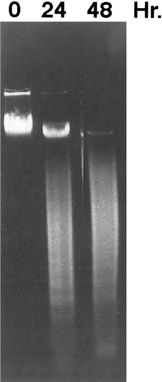 Fig. 3. DNA fragmentation induced by CD437 in HL-60R cells. HL-60R cells were grown as described in the Materials and Methods. CD437 was added to a final concentration of 1 μmol/L and cells were harvested. DNA was extracted and fractionated by gel electrophoresis as described in the Materials and Methods.