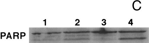 Fig. 8. CD437-mediated apoptosis in primary leukemia cells. Leukemic blasts were isolated as described in the Materials and Methods. Cells were exposed to 1 μmol/L CD437 for various periods of time and PARP cleavage was assessed as previously described. (A) Leukemic cells exposed only to vehicle for 48 hours. (B) Leukemic cells exposed to 1 μmol/L CD437 for 48 hours. (C) CD437-mediated PARP cleavage. Lanes 1 and 3, cells exposed to vehicle only for 24 and 48 hours, respectively. Lanes 2 and 4, cells exposed to 1 μmol/L CD437 for 24 and 48 hours, respectively.