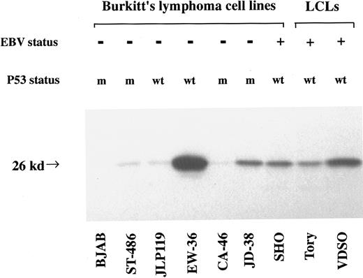 Fig. 2. Western blot analysis of Bcl-2 levels in BL cell lines and EBV-transformed LCLs. Total cell extracts from equal numbers of cells (∼50,000) were loaded in each lane. The figure shows immunoblot results obtained using a monoclonal antibody to human Bcl-2 (see the Materials and Methods). Also indicated are the p53 mutation (m indicates presence of 1 or 2 mutated alleles) and EBV infection status (+ indicates infected) for each cell line.