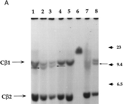 Fig. 1. Analysis of TCR and immunoglobulin gene rearrangements in EBV-transformed T cells. (A) EcoRI digested NC5 (lane 2) and TC (lane 3) DNA and control DNA from purified non-T, non-B human peripheral mononuclear cells (lane 1), monocytic cell line U937 (lane 4), EBV-LCL (lane 5), purified peripheral blood T cells (lane 7), and T-cell lymphoma Jurkat (lane 8) were analyzed with a 496-bp human Cβ1 cDNA probe. The sizes of the Cβ-germline restriction fragments obtained from non-T cells were 12 and 4.2 kb for Cβ1 and Cβ2, respectively (large arrows). The additional rearranged band (small arrows) of approximately 10 kb detected in EBV-transformed T cells (lanes 2 and 3) and in Jurkat cells (lane 8) showed the clonality of these cell populations, whereas in polyclonal purified T cells from peripheral blood, the mixture of all possible rearrangements is shown by a smear (lane 7). The molecular weight markers (MW II; Boehringer Mannheim) were loaded in lane 6. (B) The rearrangement of immunoglobulin heavy chains was analyzed by using primers specific for the VJ region of immunoglobulins amplifying a 105-bp fragment of DNA from an EBV-LCL (lane 5), the EBV-transformed T cell NC5 (lane 6), the EBV-transformed T cell TC (lane 7), or Jurkat cells (lane 8). To control for DNA integrity primers amplifying a 350-bp fragment inside an exon of the Cμ heavy chain region (lanes 1 to 4) or primers amplifying a 250-bp inside an exon of the Cβ chain of the TCR (lanes 8 to 12) were used on the DNA from an EBV-LCL (lanes 1 and 9), the EBV-transformed T cell NC5 (lanes 2 and 10), the EBV-transformed T cell TC (lanes 3 and 11), or Jurkat cells (lanes 4 and 12).