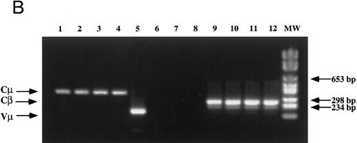 Fig. 1. Analysis of TCR and immunoglobulin gene rearrangements in EBV-transformed T cells. (A) EcoRI digested NC5 (lane 2) and TC (lane 3) DNA and control DNA from purified non-T, non-B human peripheral mononuclear cells (lane 1), monocytic cell line U937 (lane 4), EBV-LCL (lane 5), purified peripheral blood T cells (lane 7), and T-cell lymphoma Jurkat (lane 8) were analyzed with a 496-bp human Cβ1 cDNA probe. The sizes of the Cβ-germline restriction fragments obtained from non-T cells were 12 and 4.2 kb for Cβ1 and Cβ2, respectively (large arrows). The additional rearranged band (small arrows) of approximately 10 kb detected in EBV-transformed T cells (lanes 2 and 3) and in Jurkat cells (lane 8) showed the clonality of these cell populations, whereas in polyclonal purified T cells from peripheral blood, the mixture of all possible rearrangements is shown by a smear (lane 7). The molecular weight markers (MW II; Boehringer Mannheim) were loaded in lane 6. (B) The rearrangement of immunoglobulin heavy chains was analyzed by using primers specific for the VJ region of immunoglobulins amplifying a 105-bp fragment of DNA from an EBV-LCL (lane 5), the EBV-transformed T cell NC5 (lane 6), the EBV-transformed T cell TC (lane 7), or Jurkat cells (lane 8). To control for DNA integrity primers amplifying a 350-bp fragment inside an exon of the Cμ heavy chain region (lanes 1 to 4) or primers amplifying a 250-bp inside an exon of the Cβ chain of the TCR (lanes 8 to 12) were used on the DNA from an EBV-LCL (lanes 1 and 9), the EBV-transformed T cell NC5 (lanes 2 and 10), the EBV-transformed T cell TC (lanes 3 and 11), or Jurkat cells (lanes 4 and 12).