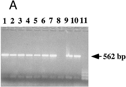 Fig. 2. Detection of EBV DNA in EBV-transformed T cells. (A) EBV DNA was detected by PCR analysis on DNA extracted from seven different EBV-transformed T-cell lines (EBV 41, T1B5, TFS, 2C8, 2G4, 2G8, NC5, respectively, lanes 1 to 7), a T-cell lymphoma Jurkat (lane 8), or two EBV-LCLs (lanes 9 and 10), or a control without DNA (lane 11) using primer pairs specific for LMP-1 amplifying a 562-bp fragment. (B) The presence of EBV DNA in EBV-transformed T cells (NC5 and TC) was confirmed by Southern blot hybridization on 10 μg of EcoRI digested genomic DNA (lanes 1 to 4) or on BamHI digested Hirt extract from 2 × 106 cells (lanes 6 to 9) with a LMP-1 specific probe. Lanes 4 and 9, EBV LCL; lanes 3 and 8, Jurkat cells; lanes 2 and 7, NC5 cells; lanes 1 and 6, TC cells; lanes 5 and 10, molecular weight markers II (Boehringer Mannheim, France).