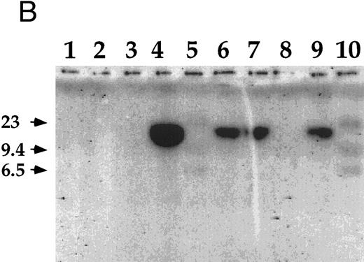 Fig. 2. Detection of EBV DNA in EBV-transformed T cells. (A) EBV DNA was detected by PCR analysis on DNA extracted from seven different EBV-transformed T-cell lines (EBV 41, T1B5, TFS, 2C8, 2G4, 2G8, NC5, respectively, lanes 1 to 7), a T-cell lymphoma Jurkat (lane 8), or two EBV-LCLs (lanes 9 and 10), or a control without DNA (lane 11) using primer pairs specific for LMP-1 amplifying a 562-bp fragment. (B) The presence of EBV DNA in EBV-transformed T cells (NC5 and TC) was confirmed by Southern blot hybridization on 10 μg of EcoRI digested genomic DNA (lanes 1 to 4) or on BamHI digested Hirt extract from 2 × 106 cells (lanes 6 to 9) with a LMP-1 specific probe. Lanes 4 and 9, EBV LCL; lanes 3 and 8, Jurkat cells; lanes 2 and 7, NC5 cells; lanes 1 and 6, TC cells; lanes 5 and 10, molecular weight markers II (Boehringer Mannheim, France).