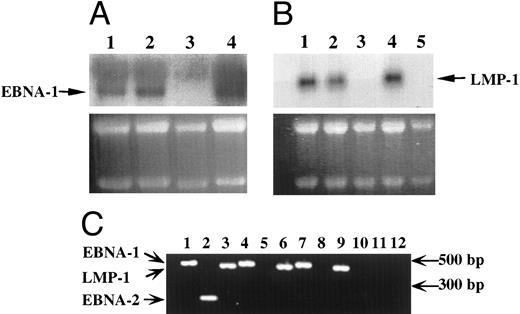 Fig. 3. Detection of EBV transcripts in EBV-transformed T-cell lines. (A) and (B) Northern blot analysis on 10 μg of total RNA isolated from the EBV-transformed T cell NC5 (lane 1), the EBV-transformed T cell TC (lane 2), a T-cell lymphoma Jurkat (lane 3), a EBV-LCL (lane 4), or peripheral blood mononuclear cells (B, lane 5) was performed using a 470-bp cDNA fragment specific for EBNA-1 (A) or a 406-bp cDNA fragment specific for LMP-1 (B). An equal amount of RNA was loaded in each lane as controlled by the intensity of the 28S and 18S bands after ethidium bromide labeling. (C) The detection of the EBV transcripts was performed by RT-PCR using the EBNA-1 primers amplifying a 470-bp fragment, the EBNA-2 primers amplifying a 177-bp fragment, and the LMP-1 primers amplifying a 406-bp fragment, described above on, respectively, an EBV-LCL (lanes 1 to 3), an EBV-transformed T cell NC5 (lanes 4 to 6,) an EBV-transformed T cell TC (lanes 7 to 9), or a T-cell lymphoma Jurkat (lanes 10 to 12). As a control for DNA contamination, RNA samples that were processed identically, but in which the reverse transcriptase had been omitted, were amplified by PCR, no positive bands were detected.
