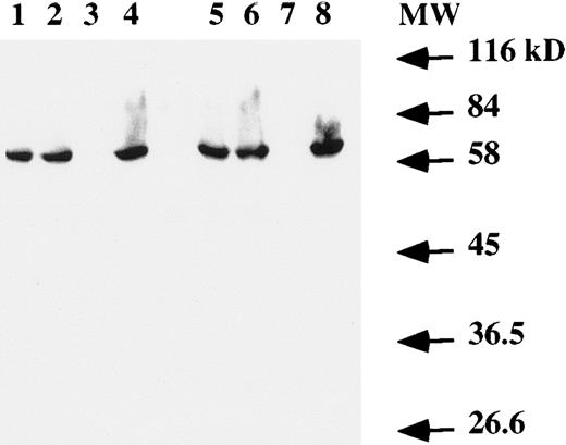 Fig. 4. Western blot analysis of EBNA-1 expression. Total protein extract from 106 (lanes 1 to 4) or 2 × 106 (lanes 5 to 8) cells were electrophoresed on a SDS-PAGE gel. After transfer to a membrane, EBNA-1 protein was revealed with an anti-EBNA–1 monoclonal antibody. Lanes 1 and 5, EBV-transformed T-cell line NC5; lanes 2 and 6, EBV-transformed T-cell line TC; lanes 3 and 7, T-cell lymphoma Jurkat; and lanes 4 and 8, EBV-LCL. The numbers on the right denote the standard molecular weights in kD.
