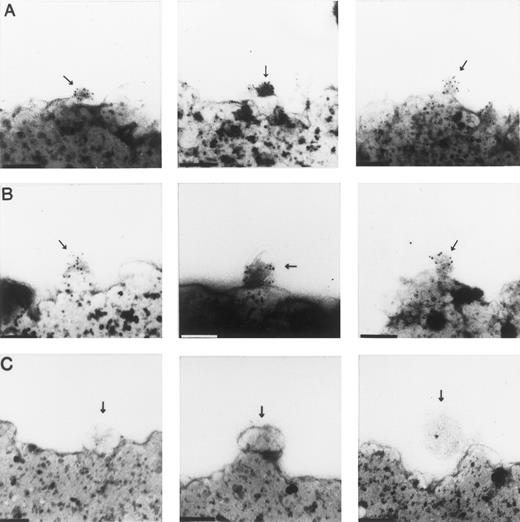 Fig. 5. Immunoelectron microscopy of vesicles isolated on magnetic beads coated with antibodies to CR1 peptides. (A) Vesicles stained with a mixture of MoAbs 3D9 and C543 to the extracellular domains of CR1. (B) Vesicles stained with antihuman albumin MoAb. (C) Vesicles stained with control nonimmune antibody MOPC 21. Arrows show vesicles specifically bound to beads bearing antibodies to CR1 tail peptides. (A) and (B) show staining with 5-nm gold-conjugated goat antimouse IgG. (C) fails to show staining with the same gold-conjugated goat antimouse IgG. Bars = 0.1 μm.