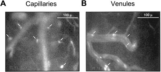 Fig. 1. Adhesion of fluorescently labeled human RBCs to rat brain microvasculature. Fluorescently labeled human RBCs were injected (200 to 500 μL) into rats prepared with a cranial window as described in the Materials and Methods. Photomicrographs of video images (original magnification ×40) in two different areas of the rat brain microvasculature are shown. Area (A) focuses on capillary size vessels. Area (B) focuses on postcapillary venules. The white arrows identify fluorescent adherent human RBCs. RBC adhesion was predominately in the capillary and postcapillary venule for both sickle and control erythrocytes (SS-RBCs are shown).