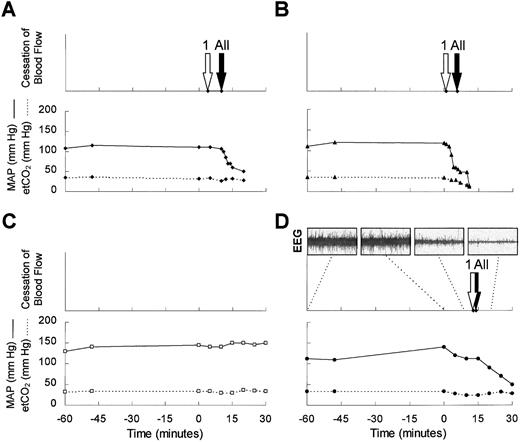 Fig. 5. Cessation of cerebral blood flow (stroke) occurred in 3 of 4 rats treated with topical L-NAME (1 mmol/L) within 30 minutes after infusion of SS-RBCs. Rats were prepared with cranial windows and superfused with artificial cerebrospinal fluid containing 1 mmol/L L-NAME beginning at time −60 minutes as described in the Materials and Methods. Fluorescently labeled human SS-RBCs (2 to 3 mL) were infused into prepared rats (completed at time 0 minutes) and video images of fluorescent RBCs in 6 preselected areas within the cranial window were obtained. MAP (solid line) and etCO2 (broken line) is plotted for each animal (A, B, C, and D) that experienced stroke (solid symbols) or maintained stable cerebral blood flow (open symbols). The open arrows depict the time that blood flow first stopped in a postcapillary venule measuring greater than 25 μm in diameter. The solid arrow depicts the time the blood flow of all vessels in all observed areas ceased. Rat B died at time 11 minutes. Because the endpoint for this investigation was stroke, the experiments were terminated in rats A and D before spontaneous death. In one experiment, an EEG over the frontal cortex was also obtained and is depicted at times −60, 0, 8, and 20 minutes (D; EEG).