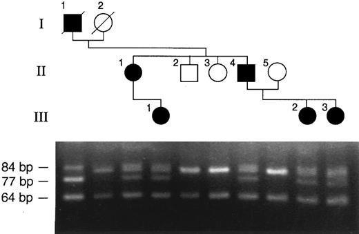 Fig. 3. Detection of the mutation by restriction endonuclease digestion of PCR-amplified DNA. The pedigree is shown at the top of the figure. Genomic DNA samples obtained from each family member were amplified using primer pair C and F as shown in Fig 1. The amplification products were digested with Rsa I and fractionated by electrophoresis in a 5% agarose gel. Digestion of the amplification products of the normal allele with Rsa I yields fragments of 84 and 64 bp, whereas the mutant allele yields fragments of 77 bp and 64 bp. None of the unaffected individuals (open symbols) have a 77-bp fragment. All affected individuals in the family (solid symbols) are heterozygous for the mutation.