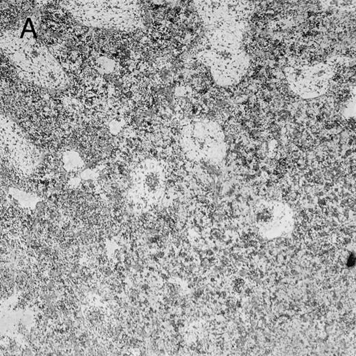 Fig. 4. Histologic findings. Organs were collected at different times after BMT and tissue sections were stained with hematoxylin and eosin. Original magnifications for spleen (left) and liver (right) are ×40 and ×100, respectively. (A) B6 mice receiving FVB BM plus EpTK T cells. (B) Control group receiving BM only. / (C) B6 mice receiving FVB BM plus EpΔTK T cells and treated with GCV. (D) B6 mice receiving FVB BM plus EpΔTK T cells, treated with GCV, and developing a late onset GVHD (day 54).