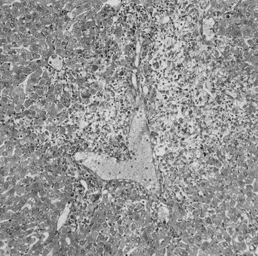 Fig. 4. Histologic findings. Organs were collected at different times after BMT and tissue sections were stained with hematoxylin and eosin. Original magnifications for spleen (left) and liver (right) are ×40 and ×100, respectively. (A) B6 mice receiving FVB BM plus EpTK T cells. (B) Control group receiving BM only. / (C) B6 mice receiving FVB BM plus EpΔTK T cells and treated with GCV. (D) B6 mice receiving FVB BM plus EpΔTK T cells, treated with GCV, and developing a late onset GVHD (day 54).