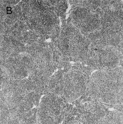 Fig. 4. Histologic findings. Organs were collected at different times after BMT and tissue sections were stained with hematoxylin and eosin. Original magnifications for spleen (left) and liver (right) are ×40 and ×100, respectively. (A) B6 mice receiving FVB BM plus EpTK T cells. (B) Control group receiving BM only. / (C) B6 mice receiving FVB BM plus EpΔTK T cells and treated with GCV. (D) B6 mice receiving FVB BM plus EpΔTK T cells, treated with GCV, and developing a late onset GVHD (day 54).