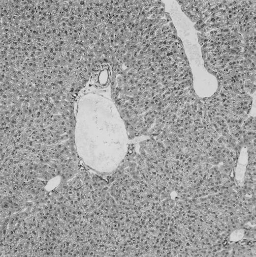 Fig. 4. Histologic findings. Organs were collected at different times after BMT and tissue sections were stained with hematoxylin and eosin. Original magnifications for spleen (left) and liver (right) are ×40 and ×100, respectively. (A) B6 mice receiving FVB BM plus EpTK T cells. (B) Control group receiving BM only. / (C) B6 mice receiving FVB BM plus EpΔTK T cells and treated with GCV. (D) B6 mice receiving FVB BM plus EpΔTK T cells, treated with GCV, and developing a late onset GVHD (day 54).