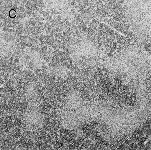 Fig. 4. Histologic findings. Organs were collected at different times after BMT and tissue sections were stained with hematoxylin and eosin. Original magnifications for spleen (left) and liver (right) are ×40 and ×100, respectively. (A) B6 mice receiving FVB BM plus EpTK T cells. (B) Control group receiving BM only. / (C) B6 mice receiving FVB BM plus EpΔTK T cells and treated with GCV. (D) B6 mice receiving FVB BM plus EpΔTK T cells, treated with GCV, and developing a late onset GVHD (day 54).