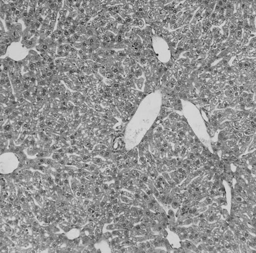 Fig. 4. Histologic findings. Organs were collected at different times after BMT and tissue sections were stained with hematoxylin and eosin. Original magnifications for spleen (left) and liver (right) are ×40 and ×100, respectively. (A) B6 mice receiving FVB BM plus EpTK T cells. (B) Control group receiving BM only. / (C) B6 mice receiving FVB BM plus EpΔTK T cells and treated with GCV. (D) B6 mice receiving FVB BM plus EpΔTK T cells, treated with GCV, and developing a late onset GVHD (day 54).
