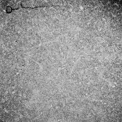 Fig. 4. Histologic findings. Organs were collected at different times after BMT and tissue sections were stained with hematoxylin and eosin. Original magnifications for spleen (left) and liver (right) are ×40 and ×100, respectively. (A) B6 mice receiving FVB BM plus EpTK T cells. (B) Control group receiving BM only. / (C) B6 mice receiving FVB BM plus EpΔTK T cells and treated with GCV. (D) B6 mice receiving FVB BM plus EpΔTK T cells, treated with GCV, and developing a late onset GVHD (day 54).