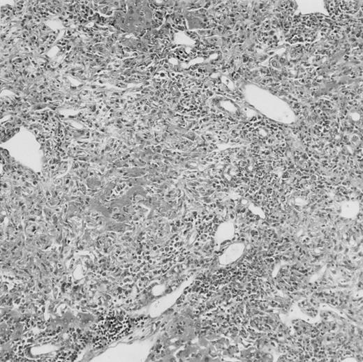 Fig. 4. Histologic findings. Organs were collected at different times after BMT and tissue sections were stained with hematoxylin and eosin. Original magnifications for spleen (left) and liver (right) are ×40 and ×100, respectively. (A) B6 mice receiving FVB BM plus EpTK T cells. (B) Control group receiving BM only. / (C) B6 mice receiving FVB BM plus EpΔTK T cells and treated with GCV. (D) B6 mice receiving FVB BM plus EpΔTK T cells, treated with GCV, and developing a late onset GVHD (day 54).