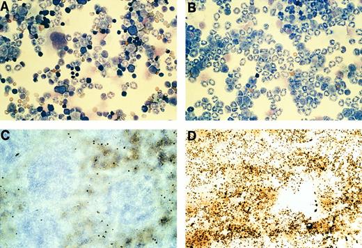 Fig. 4. Phenotype of nonleukemic hCG–PML-RARα transgenic mice. (A) Photograph of nontransgenic bone marrow cells stained with Wright's Giemsa. (B) Photograph of bone marrow cells from a nonleukemic, transgene-expressing mouse from founder line 83, stained with Wright's Giemsa. Note that the marrow of this mouse contains predominantly myeloid cells at all stages of differentiation. (C and D) Photographs of spleen sections from (C) a nontransgenic mouse or (D) a nonleukemic, transgene-expressing mouse after histochemical staining for myeloperoxidase activity. A marked increase in cells staining for MPO activity (black stain) is observed in the transgenic spleen.