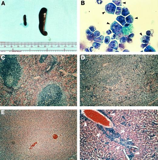 Fig. 7. Phenotype of leukemic, hCG–PML-RARα transgenic mice. (A) Spleens from a nontransgenic littermate (left) and an hCG–PML-RARα transgenic mouse (no. 135-448) with leukemia (right). (B) Bone marrow cells from a leukemic mouse (no. 137-1106) stained with modified Wright's Giemsa. This marrow from the leukemic mouse consists predominantly of very immature myeloid cells that contain abundant azurophil granules (black arrowheads). (C and D) Spleen sections from a nontransgenic mouse (C) or a transgenic mouse (no. 135-448) (D) with leukemia, stained with hematoxylin and eosin. Note the effacement of follicular structures by the leukemic infiltrate. (E and F ) Liver sections from a nontransgenic mouse (E) or mouse no. 135-448 (F ) stained with hematoxylin and eosin. Note the infiltration of the liver with immature myeloid cells (white arrowheads).
