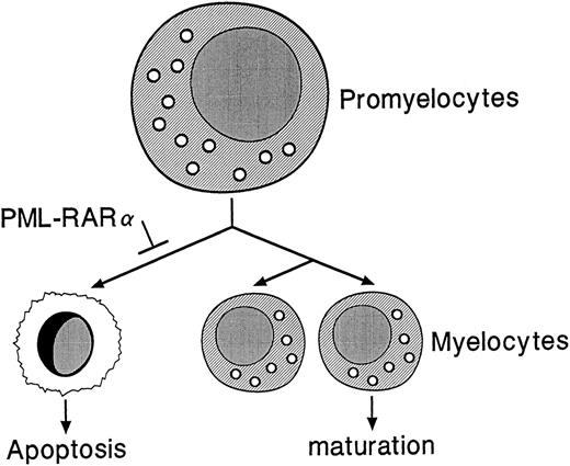 Fig. 9. Proposed model for the role of PML-RARα in altered myeloid development. PML-RARα expression in promyelocytes may block a normal apoptotic pathway, allowing some promyelocytes to survive and accumulate second hits that could lead to the development of acute leukemia.