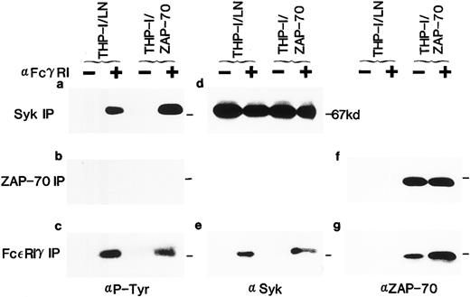 Fig. 2. Expression of ZAP-70 and its association with the FcεRIγ subunit in THP-1 cells. Lysates from unstimulated (−) or FcγRI-stimulated (+) THP-1/LN or THP-1/ZAP-70 cells were immunoprecipitated with polyclonal rabbit anti-Syk (a and d), anti–ZAP-70 (b and f ), or anti-FcεRIγ (c, e, and g) antibodies and separated on 7.5% polyacrylamide gels. Blots were probed with either a monoclonal antiphosphotyrosine (a, b, and c), polyclonal rabbit anti-Syk (d and e), or monoclonal anti–ZAP-70 (f and g) antibody. The position of the 67-kD molecular weight marker is indicated in each panel (−). These data are representative of results obtained in five independent experiments.