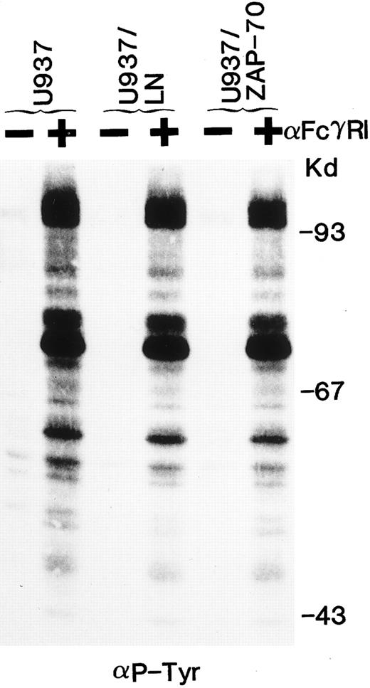 Fig. 6. The global tyrosine phosphorylation pattern after FcγRI clustering is not affected by ZAP-70 expression. Uninfected U937 cells or U937 cells expressing Neo (LN) or ZAP-70 were either unstimulated (−) or cross-linked with an FcγRI MoAb (+). Lysates were fractionated by gel electrophoresis and immunoblotted with antiphosphotyrosine antibodies. These data are representative of results obtained in six independent experiments.