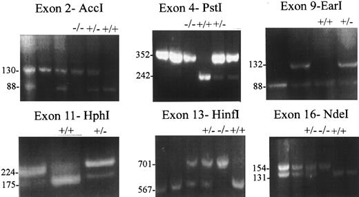 Fig. 1. ASRA of six dimorphic sites in the factor V gene. Six restriction sites in exons 2, 4, 9, 11, 13, and 16 of the factor V gene were characterized using standard PCR techniques and the enzymes Acc I, Pst I, Ear I, Hph I, HinfI, and Nde I, as indicated (see the Materials and Methods). In each case, the site was scored positive (+) if it was cleaved and negative (−) if it was not. Examples of typical cleavage patterns, eg, +/+, +/−, and −/−, for individual subjects for each dimorphism are given. Numbers alongside the gel photos indicate the size (in basepairs) of the bands.