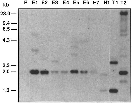 Fig. 1. Southern blot analysis of Epo-R–infected TEPC clones. Ten micrograms of Bgl II-digested genomic DNAs from different clones was analyzed on 1% agarose gel, blotted, and hybridized with a 32P NEO DNA probe. P, parental TEPC cells; E1 to E7, Epo-R–infected clones; N1, NEO-infected clone; T1, NEO-infected FDCP-1 clone; T2, Epo-R virus-producing cells.