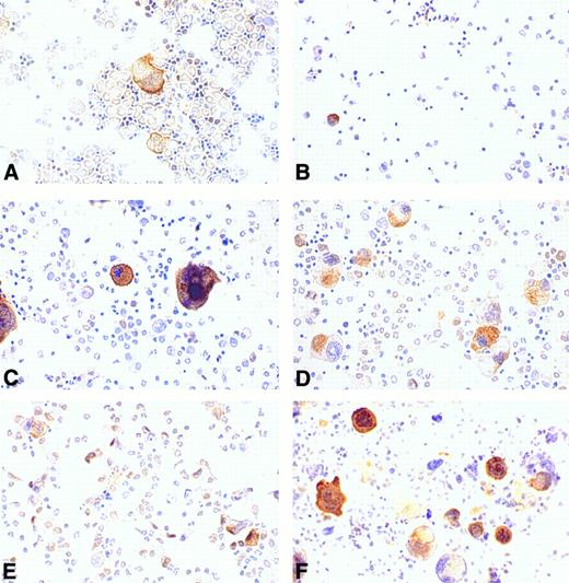 Fig. 6. Regulation of cortactin expression by hematopoieticfactors in bone marrow. Bone marrow-derived cells were prepared and cultured for 4 days as described in the Materials and Methods. (A) Fresh bone marrow cells; (B) cells in 10% fetal bovine serum; (C) cells in Tpo (200 U/mL); (D) cells in IL-3 (3 ng/mL); (E) cells in IL-11 (50 ng/mL); and (F ) cells in Tpo plus IL-11. The results shown here are representative of two experiments.
