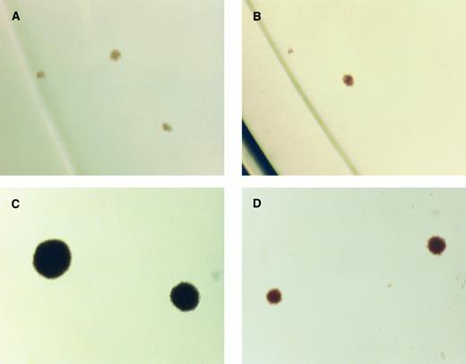Fig. 5. BFUe colonies stimulated by MoAb34 and EPO. Purified CD34+ cells from human peripheral blood were incubated for 20 days. BFUe colonies were identified by microscopic examination and photographed. Representative colonies obtained at 2 different concentrations of EPO and MoAb34, respectively, are shown. (A) 144 nmol/L MoAb34; (B) 36 nmol/L MoAb34; (C) 130 pmol/L EPO; (D) 6.6 pmol/L EPO.